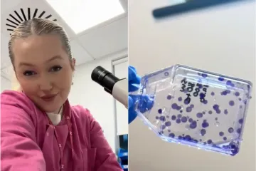 Studentica onkologije pokazala kako se šire stanice raka: Video zastrašio milijune