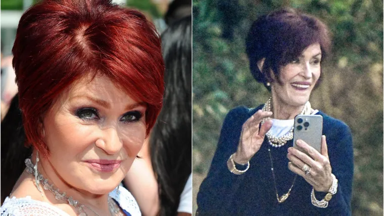 Upali obrazi i obje&scaron;ena koža: Sharon Osbourne lijek za mr&scaron;avljenje uni&scaron;tio lice