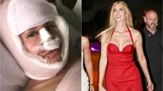 Ona je Ivanka Trump s Temua: Potro&scaron;ila masne pare na operacije sve dok kirurg nije rekao dosta