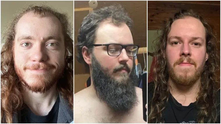 Probudili su se i napravili rez života: Nova frizura potpuno im je promjenila izgled