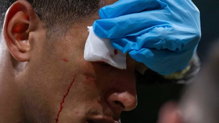 Prava tučnjava na Bernabeu! Realovac kao da je bio u ringu, Alonso poludio na svog igrača